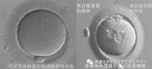 卵母细胞的识别与挑选(二)