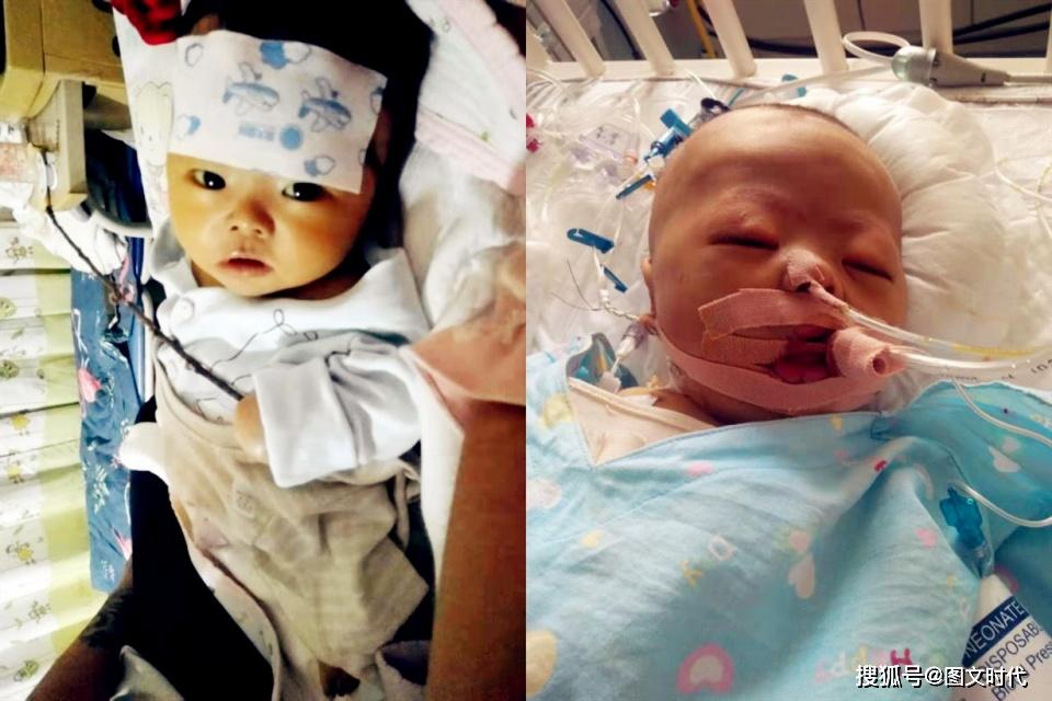 「奶奶」奶奶狠心赶病孙离家后，她自己也哭了男婴肝移植后又患癫痫