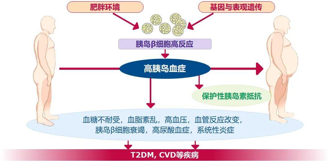 过多的状态,为恢复血糖稳态,胰岛β细胞会过度反应,出现高胰岛素血症