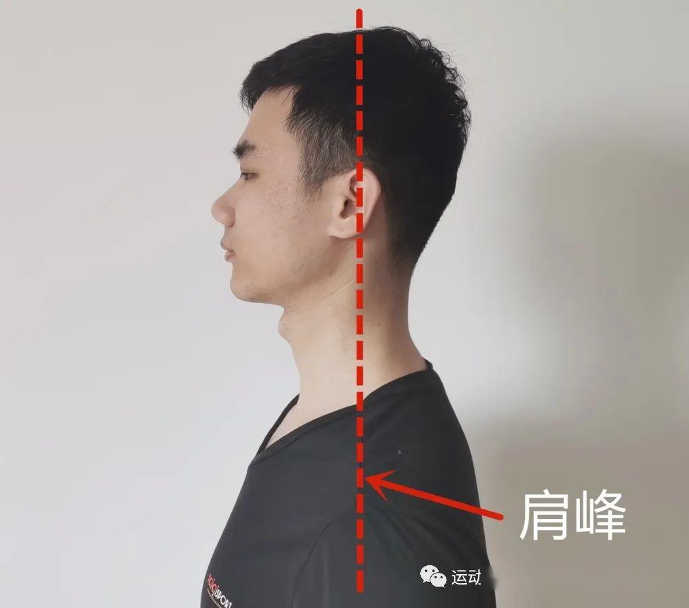 收藏青少年圆肩驼背怎么办跟着小姐姐动起来
