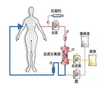 白蛋白后用速尿的原理_冷冻乙醇法分馏的主要原理是利用了血浆蛋白溶解度的不同,在血浆所含(2)