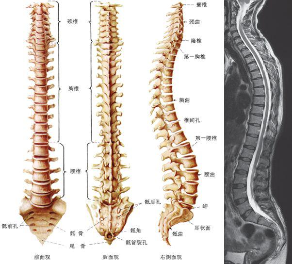 收藏贴| 颈椎、腰椎CT常见病变，你都了解吗？_手机搜狐网