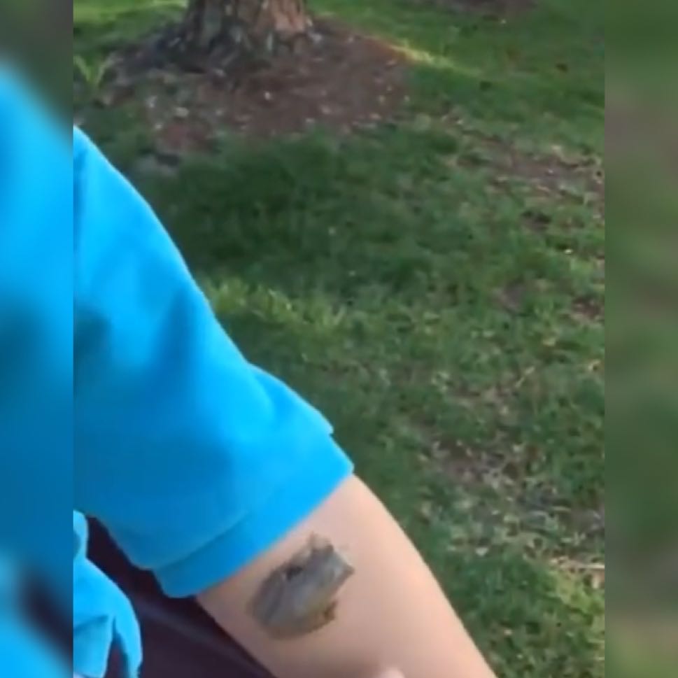 手臂■喊妈妈帮忙驱赶，却受到了“糊弄”萌娃获青蛙“青睐”驻足手臂