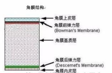 手术治疗近视眼的原理_MCT技术控制近视 非手术治疗近视的首选