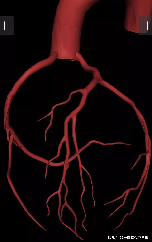 冠脉3d图解,助你轻松掌握造影体位