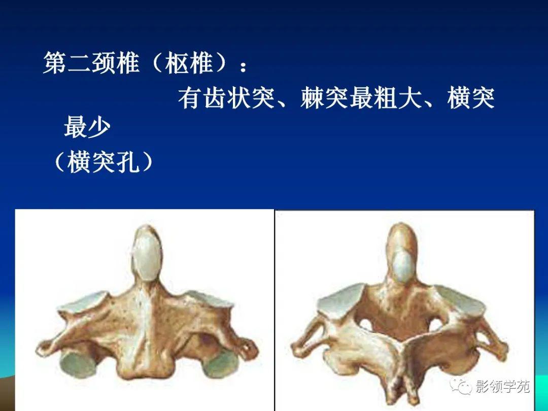 颈椎精细解剖及相关疾病影像表现