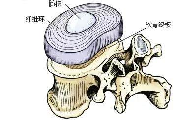 看腰椎间盘突出就是这样被坐出来的你还不改一改