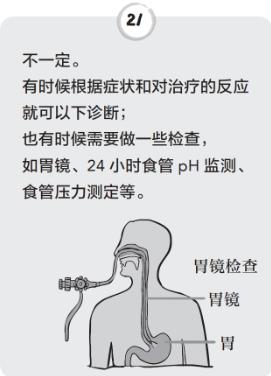 烧心是什么原理_烧心吃什么药(2)