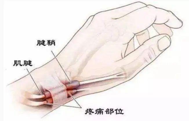 『活动』让妈妈远离“妈妈手”爱妈妈