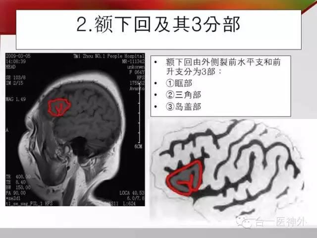 头颅mri矢状面脑沟回七大征象