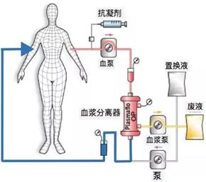 白蛋白后用速尿的原理_冷冻乙醇法分馏的主要原理是利用了血浆蛋白溶解度的不同,在血浆所含(3)