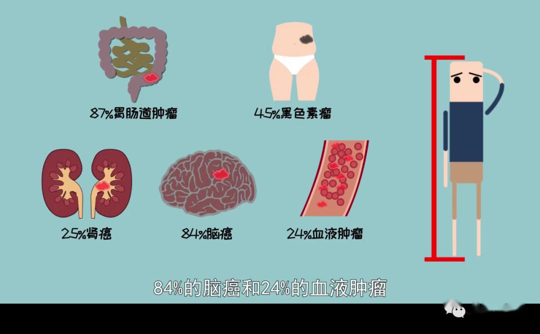 国家癌症中心还羡慕大高个吗？个高竟是男性比女性更易患癌的原因