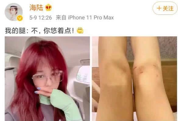 卧蚕眼睛怎么练 1cc8e1fe2b974af6b0b76385178e376b.jpeg