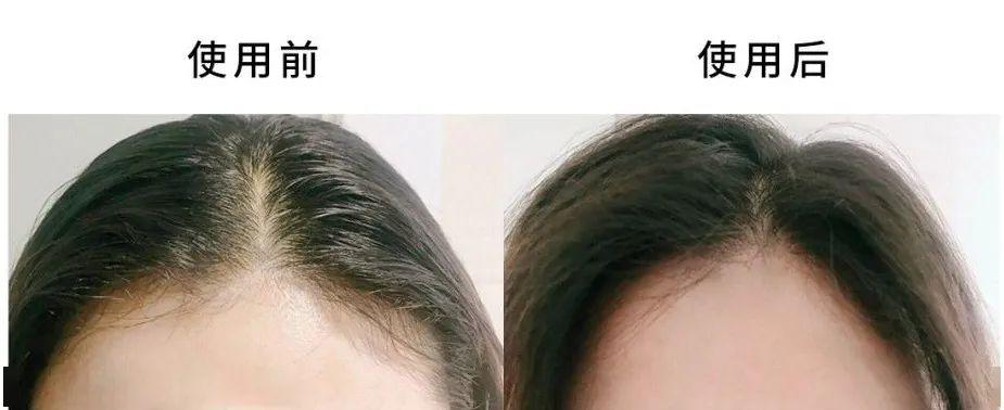 夏天头发油腻扁塌怎么办?用"5合1"的它洗头,3天都不油