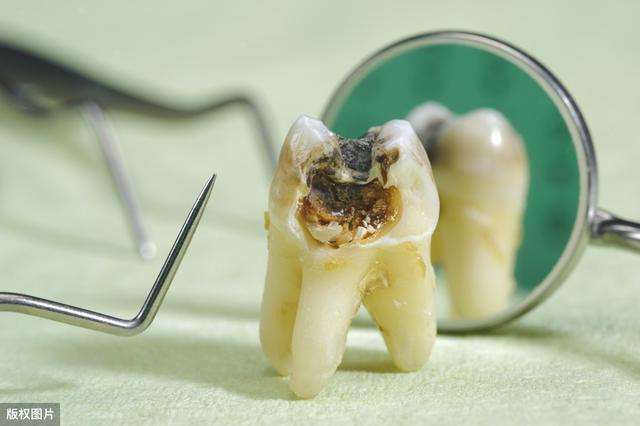 牙医行业究竟有多黑?