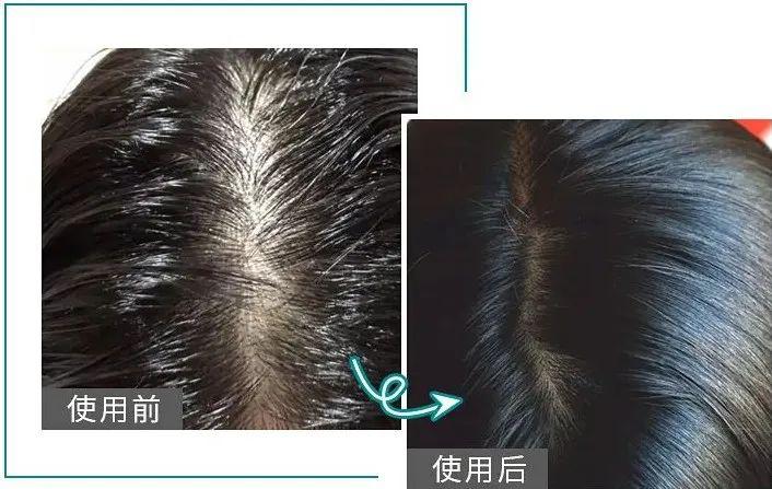 夏天头发油腻扁塌怎么办?用"5合1"的它洗头,3天都不油