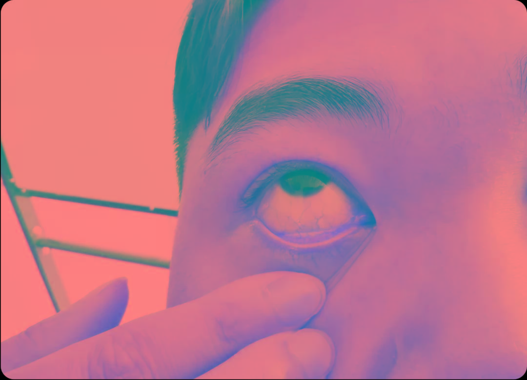 关注眼健康，远离眼部问题——蓝莓叶黄素润目冷敷凝胶（洗眼型）