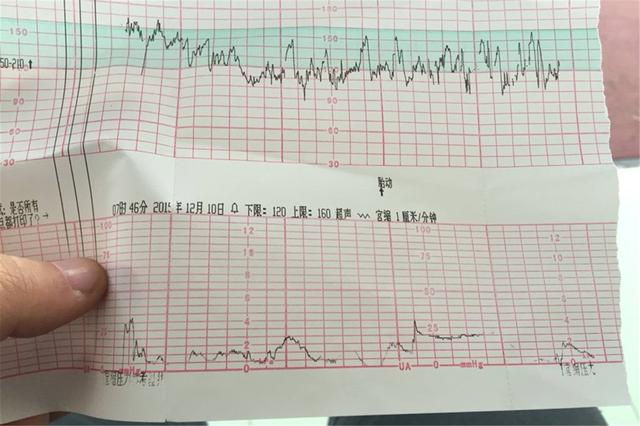 几个月做胎心监护比较好 7e21a586e3d14642b6969b00ef6fde5c.jpeg