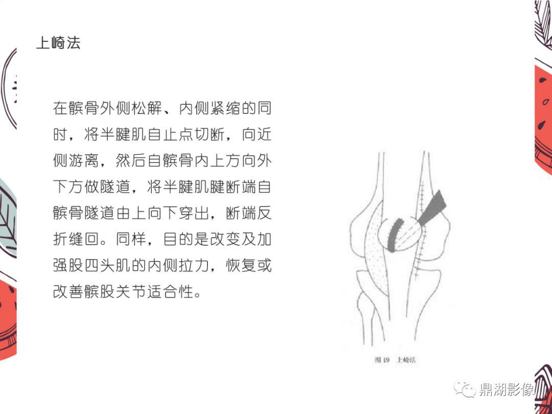 5,压痛:多分布在髌骨内缘及内侧支持带处.
