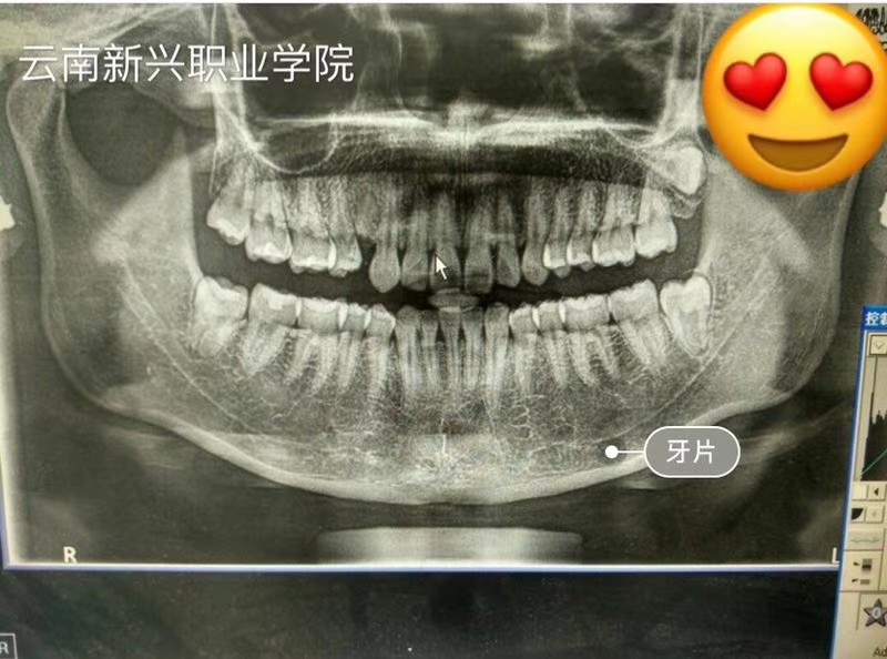 口腔组织病理学,口腔解剖生理学,口腔材料学,牙体牙髓病学,牙周病学