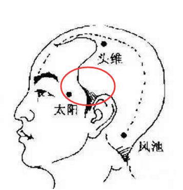 及后脑勺偏两侧的位置,属少阳经1,后脑勺中间疼,属太阳经头疼的位置