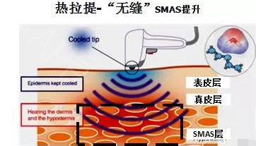 乳贴的原理是什么_乳贴是什么东西图片(2)