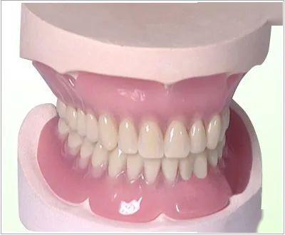 制作全口义齿时的三种颌位关系