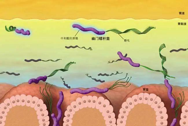 科普视窗|关于幽门螺杆菌,不得不说的那些事儿