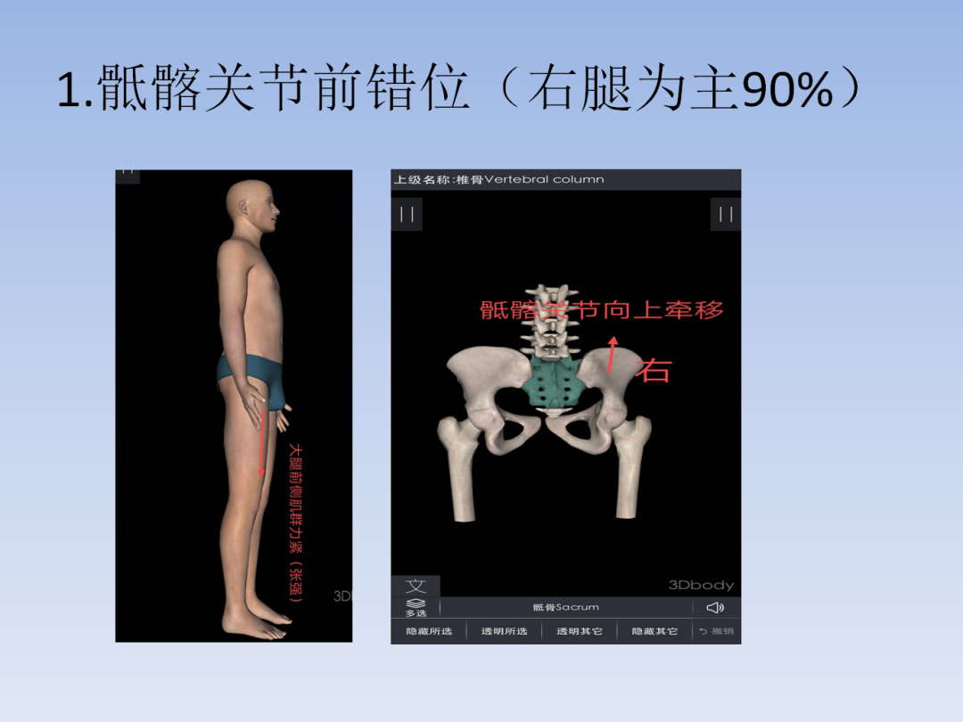 泰茗医:韦茂亮主讲《骶髂关节错位的诊断和康复》