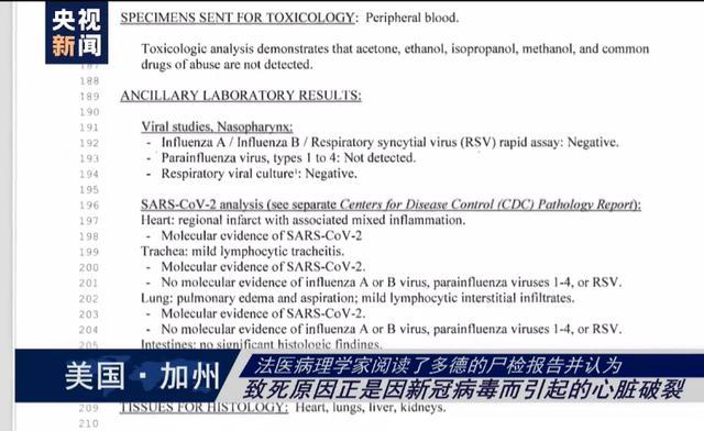 新冠死亡病例人口结构_新冠确诊病例单图片(3)