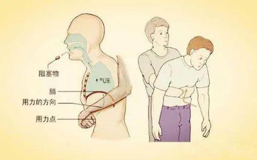 【孩子】正在威胁孩子生命4岁幼儿被窗帘绳勒死！爸妈忽略的这几件“小事”