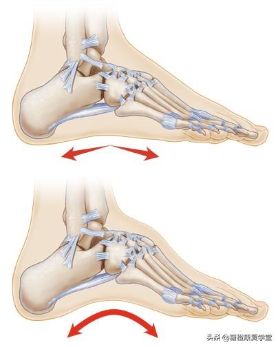 全身酸痛找不到原因,都是因为高弓足?(1)