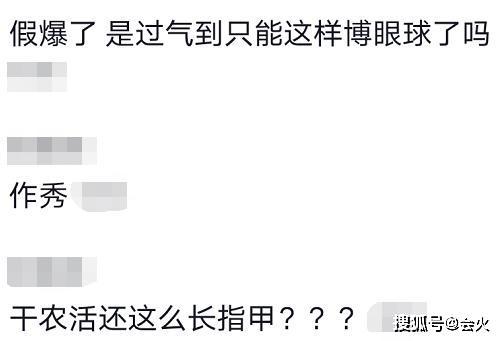 张馨予徒手干农活，手背伤口还没头发粗？超大