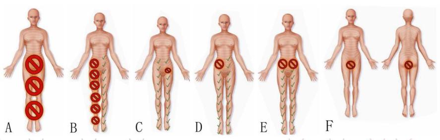 处理实用！分娩镇痛相关问题及处理