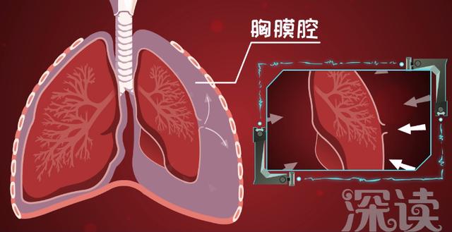 气体本来应该在肺泡里待着,突然肺泡破了个洞,气体直接进入胸膜腔