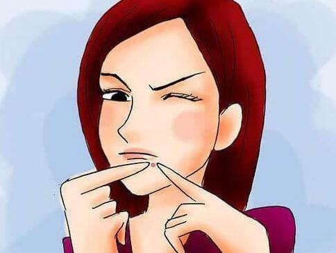 长痘后留痘印有3个高发期,如何避免痘印找上,预防是关键