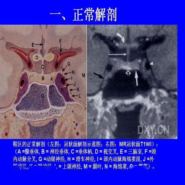 鞍区病变影像诊断上