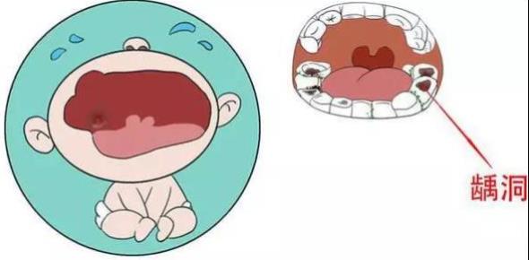 [江湖]这些关于宝宝牙齿的江湖传言 妈妈你中招了吗？