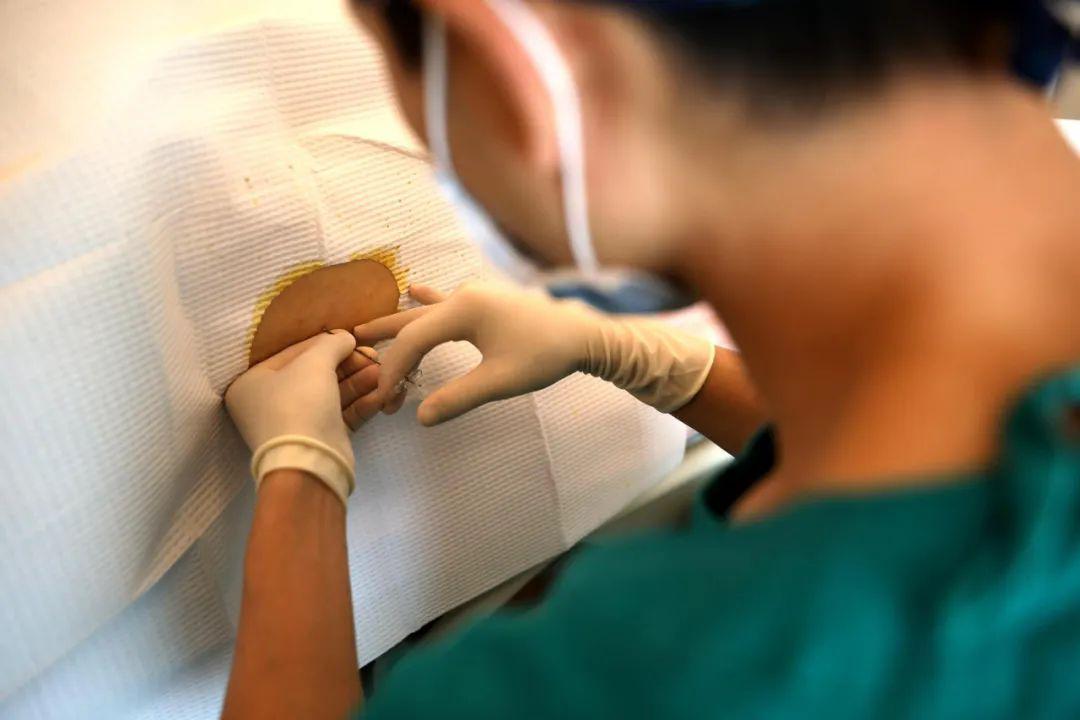 处理实用!分娩镇痛相关问题及处理