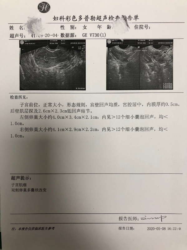 28岁女士子宫肌瘤术后复发宫茹清调理避免再动刀