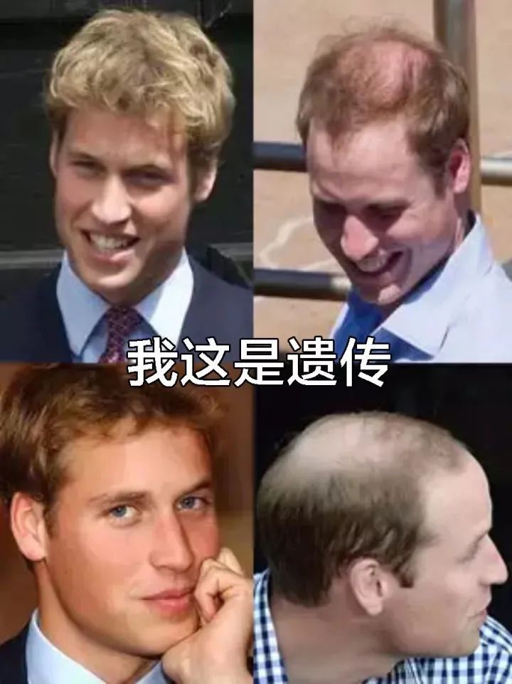 45岁贝克汉姆“秃如其来”，近照憔悴显沧桑，网