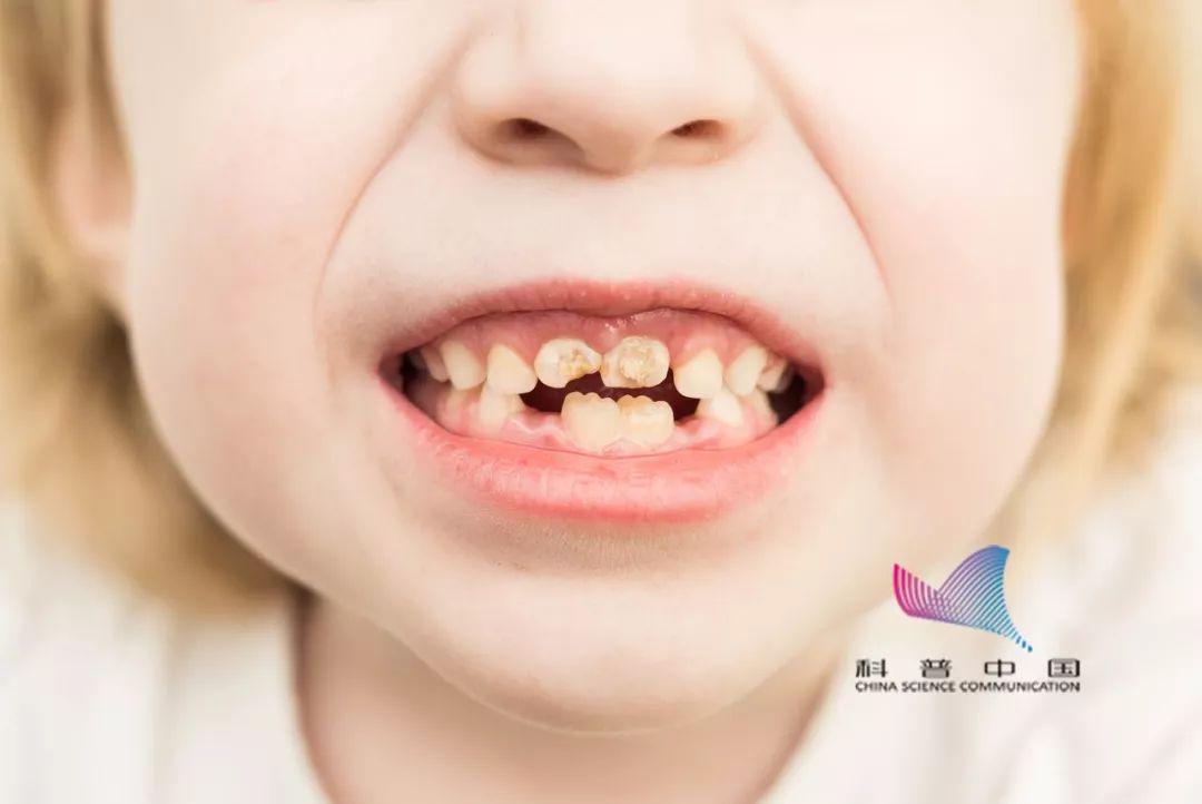 老人口气臭是什么原因_老人微信头像(3)