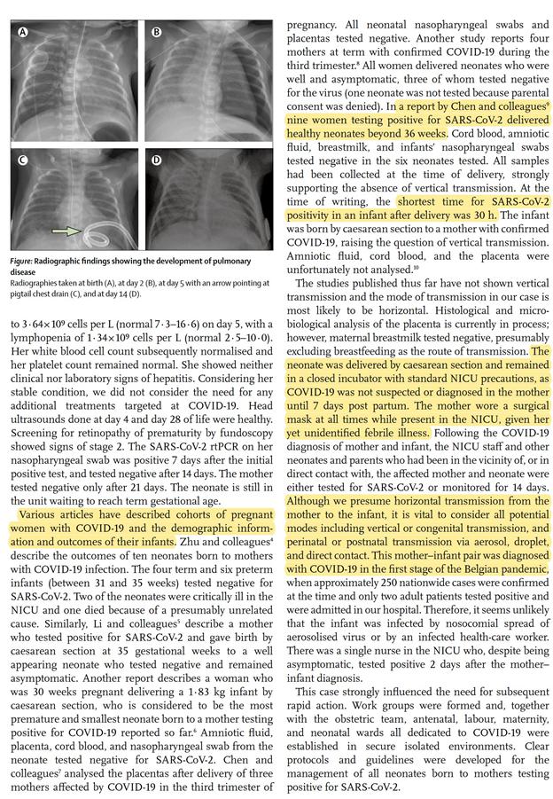 医学界|必读|全球医学界非常担忧新冠病毒感染儿童和学生