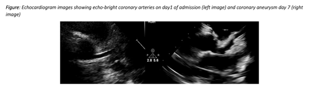 医学界|必读|全球医学界非常担忧新冠病毒感染儿童和学生