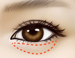 d34fa7ca00c34e969907fd1e2476a85b.png