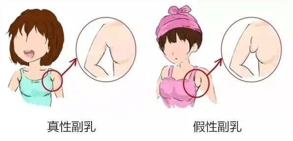 关晓彤"副乳"太明显,身材越来越有料, 网友: 鹿晗眼光