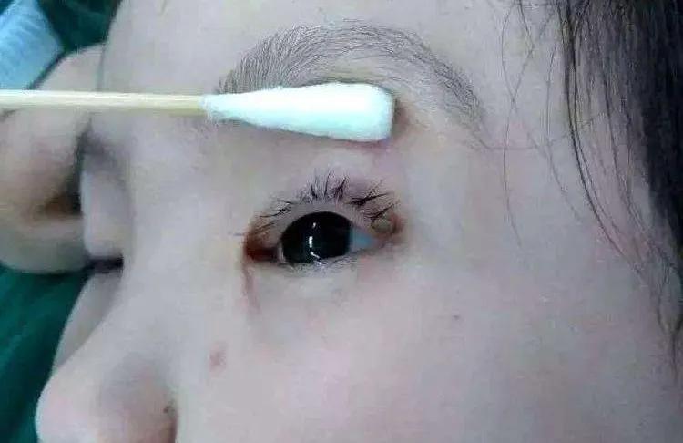 [男童]宝宝更易中招，已数千人被咬伤警惕！13岁男童被虫咬生命垂危