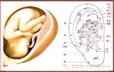 打耳朵眼的人,不容易近视;耳朵自带的"降压沟"有神奇的效果