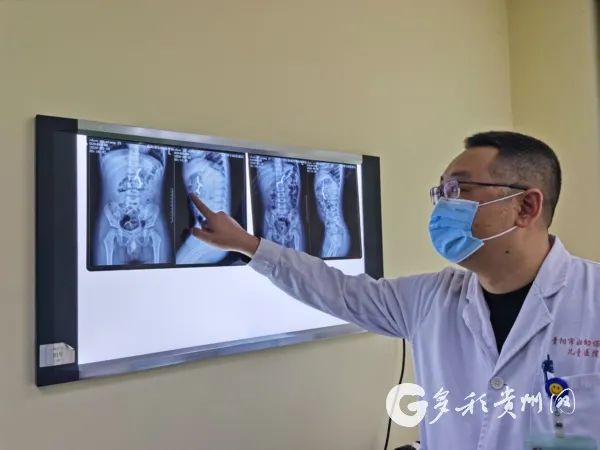 『孩子』惊险！贵州医生连续在两名儿童体内取出41颗磁力珠！一名孩子还出现胃肠穿孔……