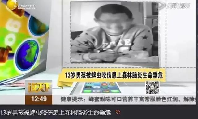 [男童]宝宝更易中招，已数千人被咬伤警惕！13岁男童被虫咬生命垂危